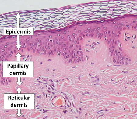 Epidermis,_papillary_dermis_and_reticular_dermis.png