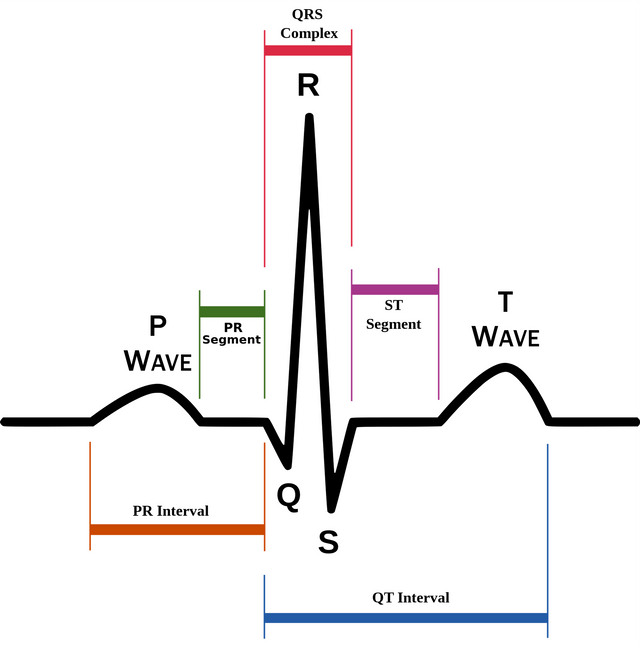 Schematic-diagram-of-normal-sinus-rhythm-for-a-human-heart-as-seen-on-ECG-Wikipedia-free-to-use.png