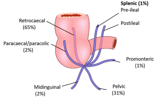 positions-of-appendix.png