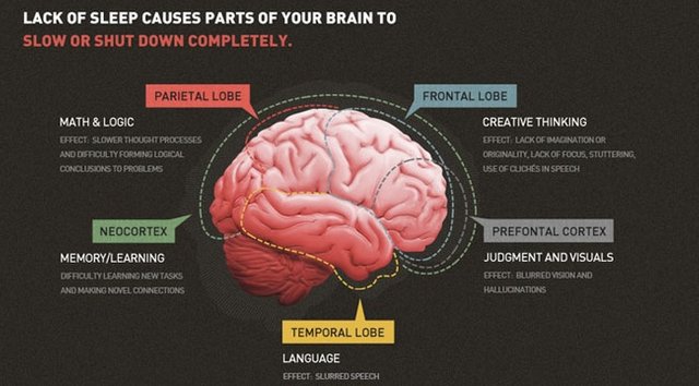 Sleep deprivation effect on brain.jpg