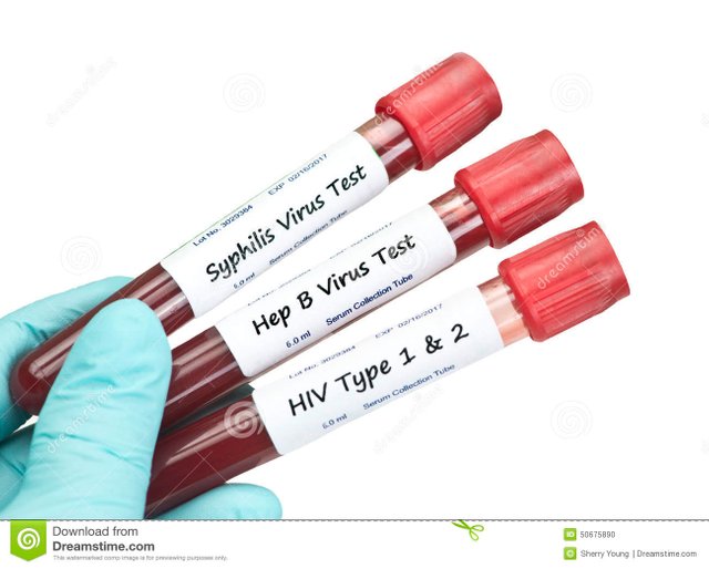 std-blood-tests-syphilis-hiv-hepatitis-b-virus-sample-collection-tubes-held-technician-labels-fictitious-serial-numbers-50675890.jpg