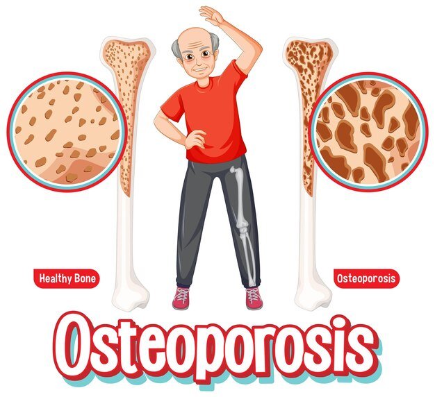 comparison-normal-bone-bone-with-osteoporosis-old-peop_1308-130013.jpg