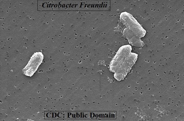 Citrobacter freundii CDC public.jpg