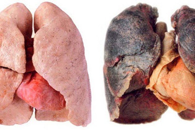 long-effects-of-smoking-respiratory-System-630x420.jpg