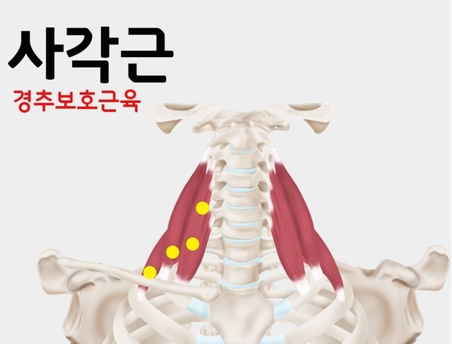 사각근 통인한의원.jpg