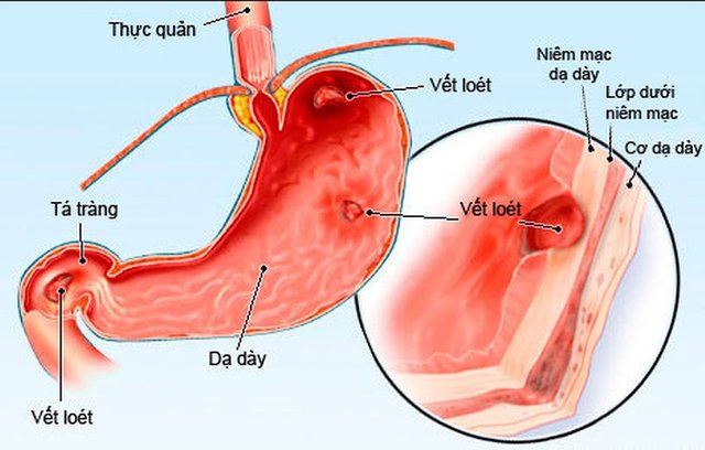 dau_da_day_do_thuoc.jpg