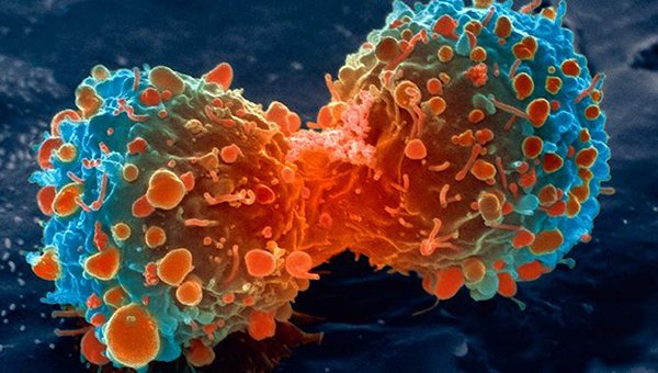 lung-cancer-cell-dividing-article.__v80030169.jpg