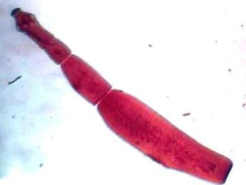 echinococcus-genus31328978675497-thumb400.jpg