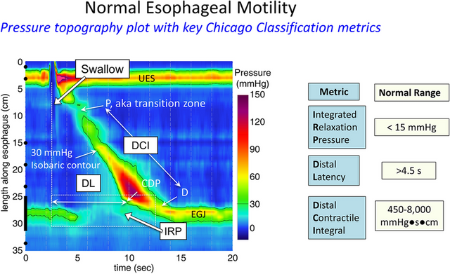 Key-Chicago-Classification-CC-metrics-used-in-the-interpretation-of-clinical-HRM.png