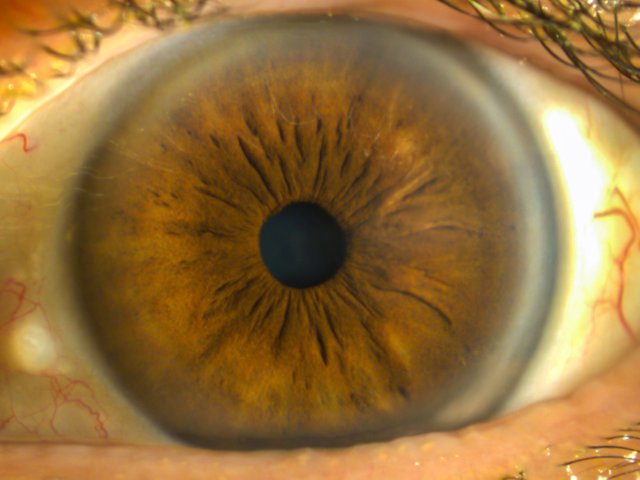 Human Eye Iris