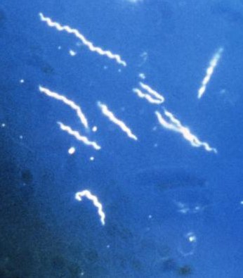 Borrelia_burgdorferi-cropped.jpg