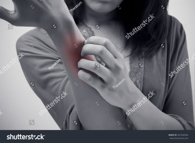 stock-photo-people-scratch-the-itch-with-hand-arm-itching-concept-with-healthcare-and-medicine-567440506.jpg