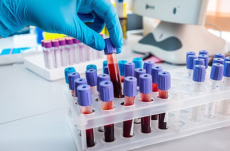 Blood Testing Technologies-AMR.jpg