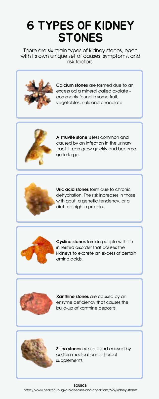 6 Types of Kidney Stones.jpg