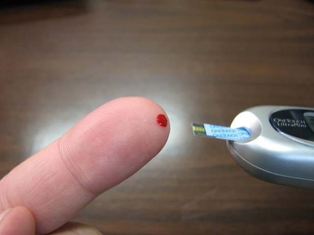 diabetes-gd6ff1e620_1280.jpg