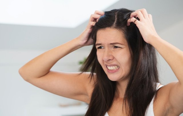 How-to-Use-Lemon-to-Get-Rid-of-Dandruff.jpg