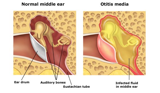 Eardrum.jpg