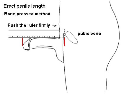 Erect_penile_length_(Bone_pressed)-.jpg