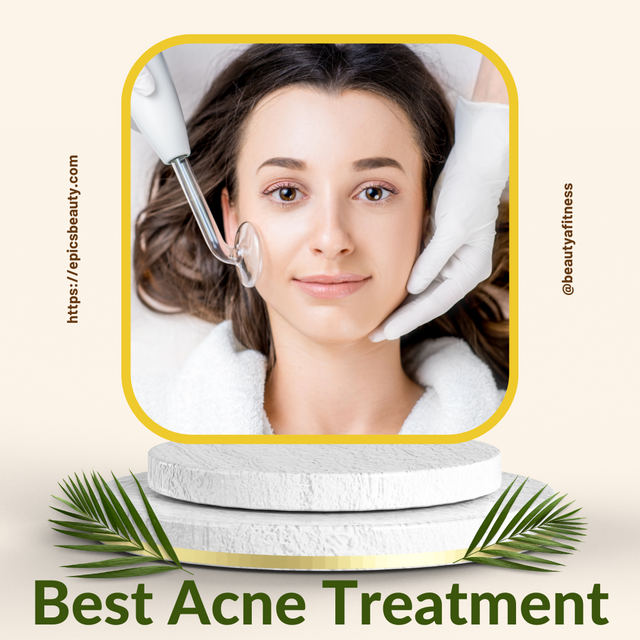 Best Acne Treatment.png