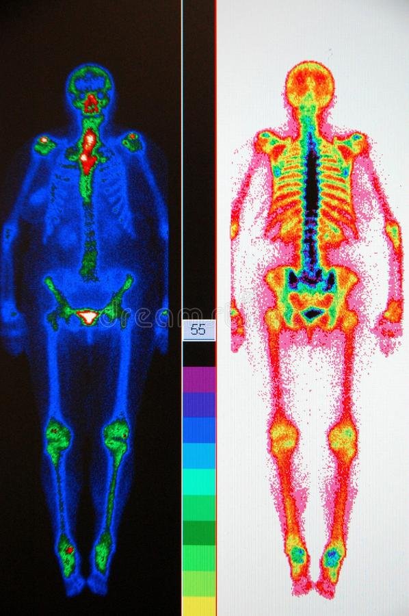 diagnostic-purpose-scan-very-useful-oncological-patients-breast-prostate-cancer-29926556.jpg