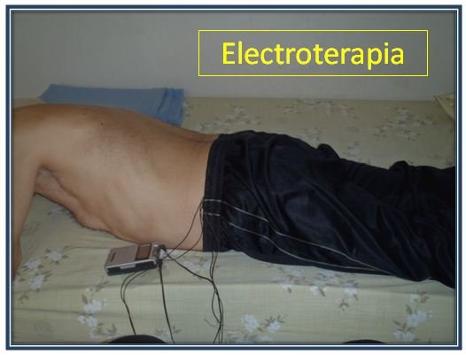 electroterapia.JPG