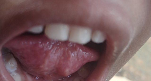 1000076775.jpg