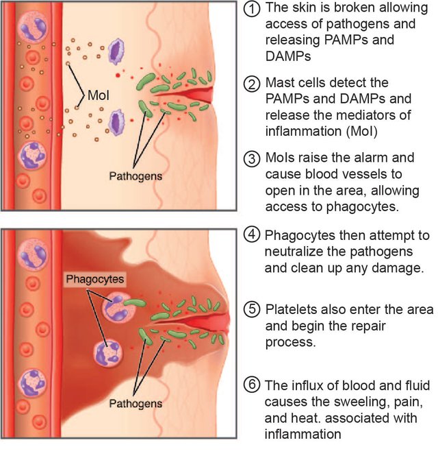 2213_Inflammatory_Process.jpg