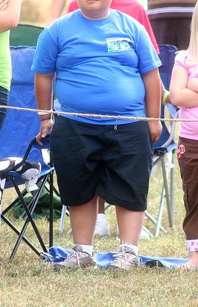 Obese child.jpg