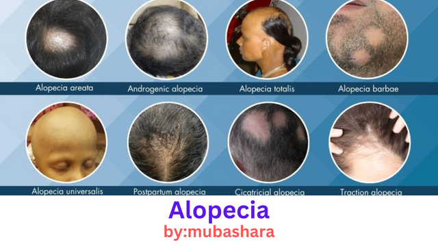 Alopecia.png