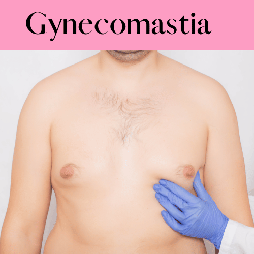 Gynecomastia surgery.png