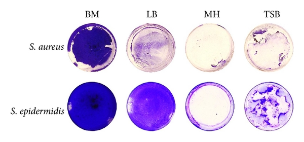 The-biofilm-formation-by-S-aureus-and-S-epidermidis-when-growing-on-Basal-medium-BM.png