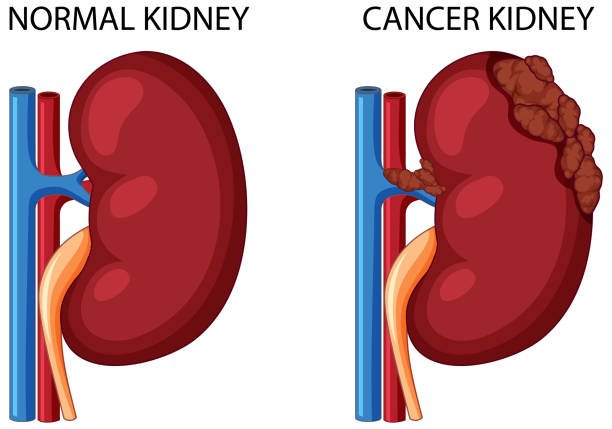 kidney pic.jpg