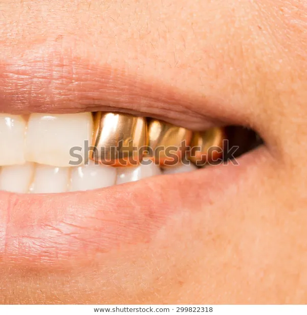 metal-teeth-mouth-600w-299822318.webp