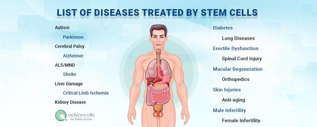 List of Diseases Treated by Stem Cell.jpg