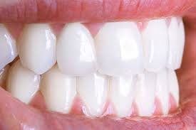 white teethning.jpg