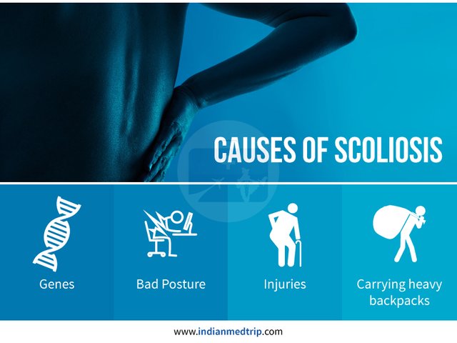 scoliosis-causes.jpg