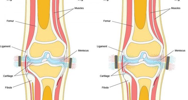 multipolar magnetic field therapy.jpeg