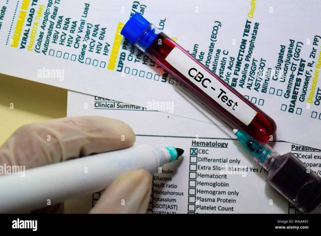 cbc-test-with-blood-sample-top-view-isolated-on-office-desk-healthcaremedical-concept-WGA46Y.jpg