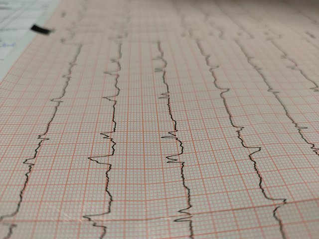 electrocardiogram-6821777_1280.jpg