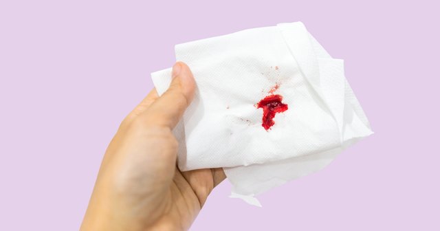 7 Surprising Reasons You’re Bleeding After Sex.jpg