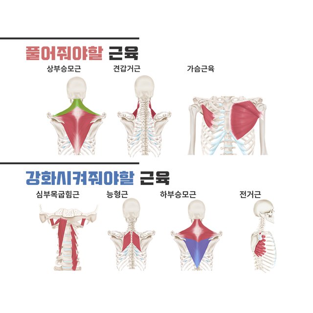 라운드숄더 근육.jpg