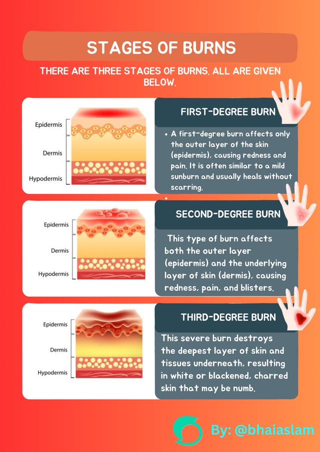 Stages of Burn. png