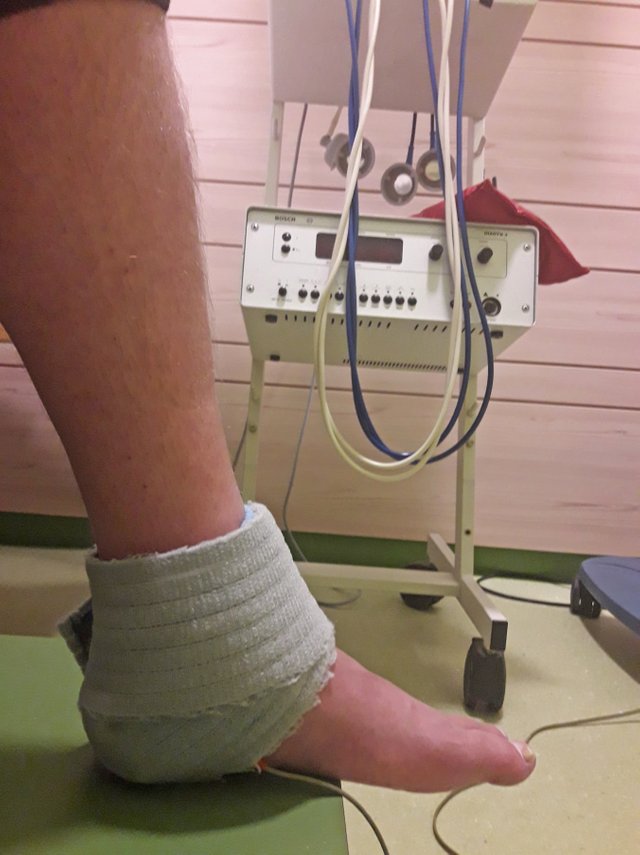 broken ankle - electrotherapy 1.jpg