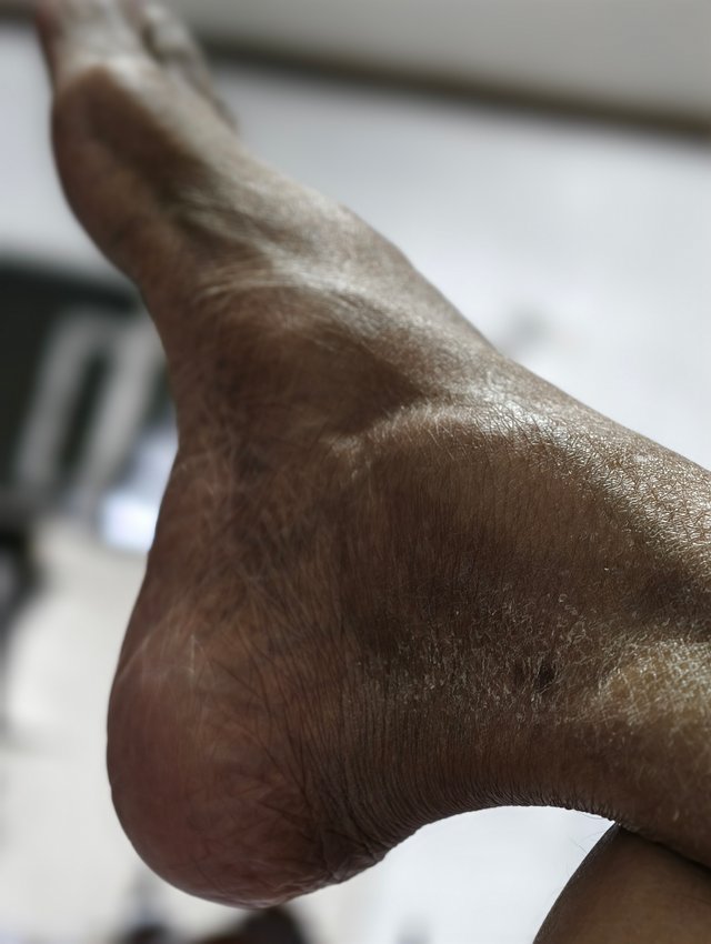 1000010221.jpg