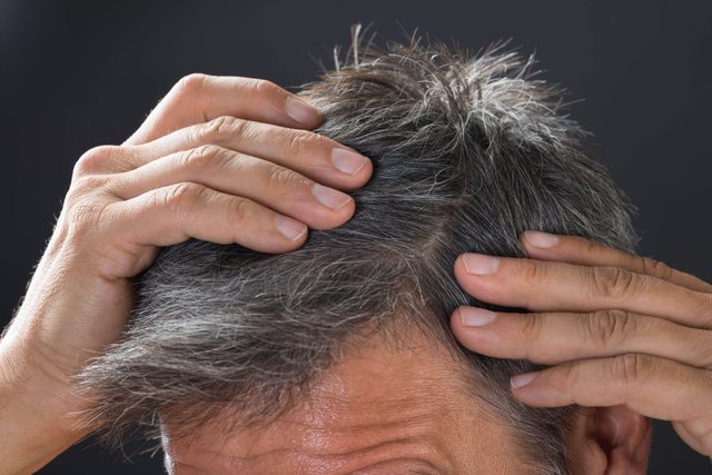 Premature-Grey-Hair-Treatment-Why-Is-Your-Hair-Losing-Its-Luster.jpg