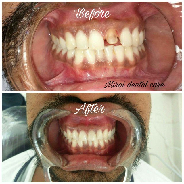 mirai-dental-care-and-implant-centre-virar-west-palghar-dentists-vwt4z.jpg