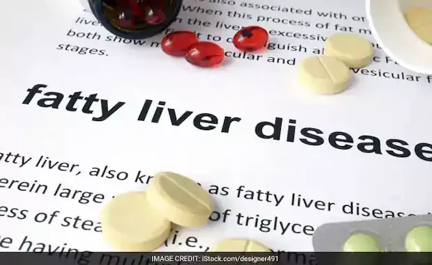 fatty-liver-disease_650x400_51475303373.webp