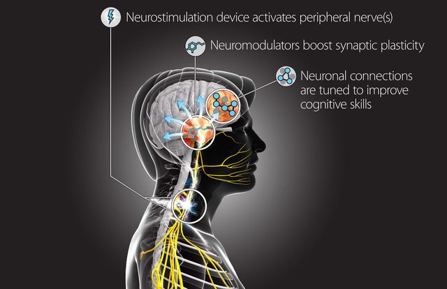 darpa-hack-brain-neurostimulation-device.jpg