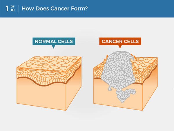 1-how-does-cancer-form.jpg