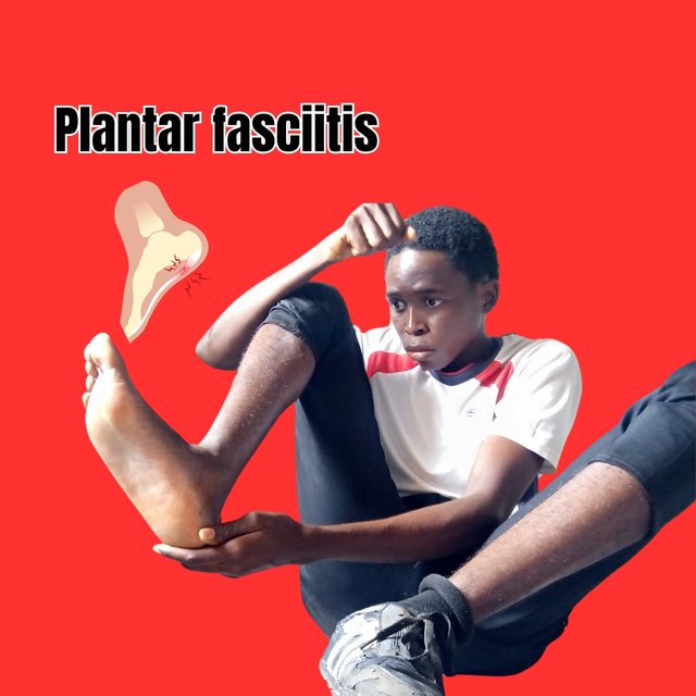 Plantar fasciitis_20241128_191252_0002.jpg